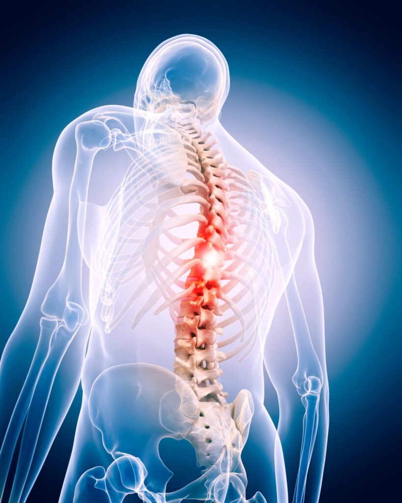 Spine Surgery